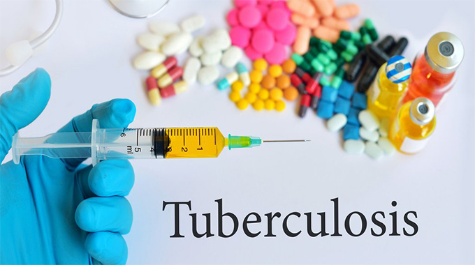 40 percent of TB patients in Zimbabwe unaware of their status